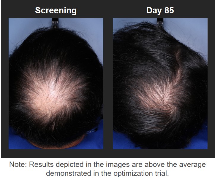Sample patient outcome from FOL-004 data